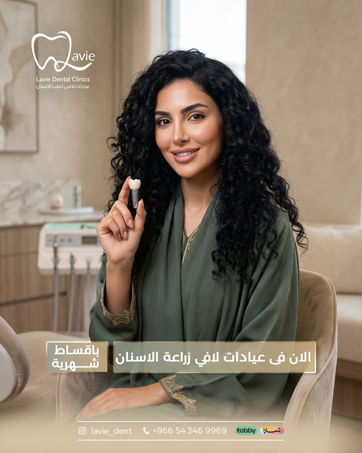 زراعة الأسنان بأقساط شهرية - عيادات لافي